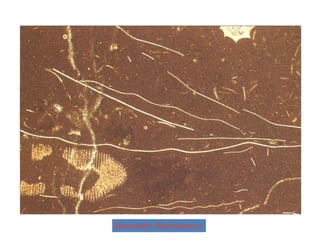 Bioclastic Wackestone
 