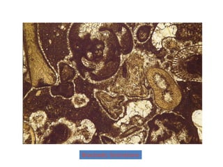 Bioclastic Grainstone
 