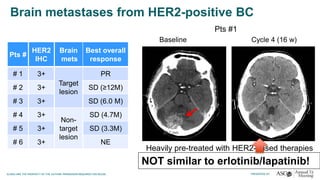 Brain metastases from HER2-positive BC
Baseline Cycle 4 (16 w)
Heavily pre-treated with HER2-based therapies
including lapatinib/capecitabine
Pts #
HER2
IHC
Brain
mets
Best overall
response
# 1 3+
Target
lesion
PR
# 2 3+ SD (≥12M)
# 3 3+ SD (6.0 M)
# 4 3+
Non-
target
lesion
SD (4.7M)
# 5 3+ SD (3.3M)
# 6 3+ NE
Pts #1
NOT similar to erlotinib/lapatinib!
 