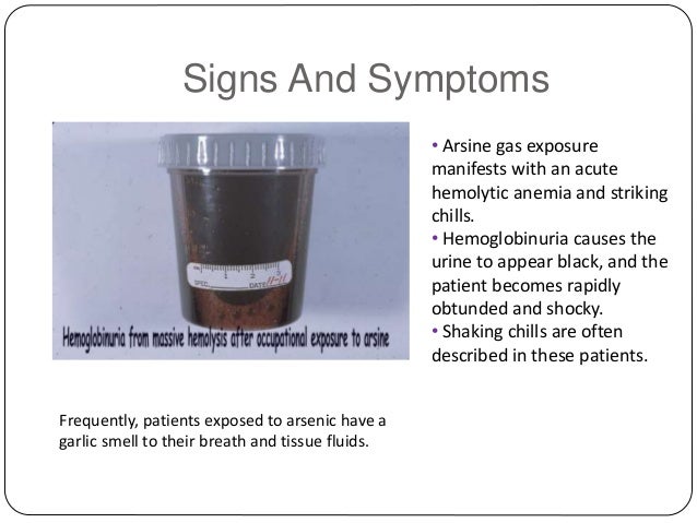 symptoms of propane poisoning symptoms of propane poisoning