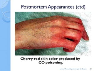 Carbon monoxide (asphyxiant) poisoning / silent killer | PPTX
