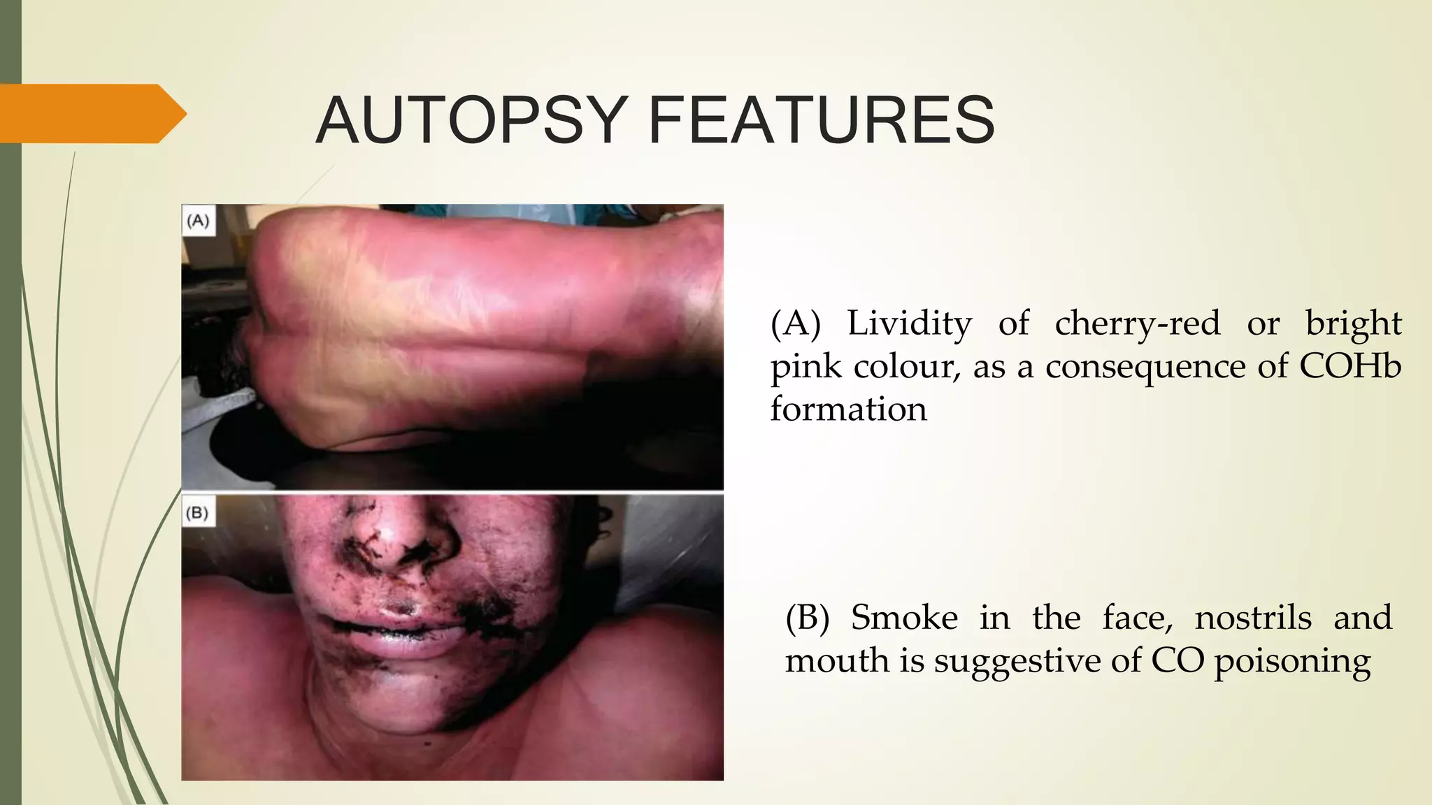 Carbon monoxide poisoning, its causes and symptoms in a dead body | PPTX