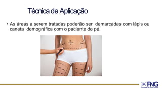• As áreas a serem tratadas poderão ser demarcadas com lápis ou
caneta demográfica com o paciente de pé.
TécnicadeAplicação
 