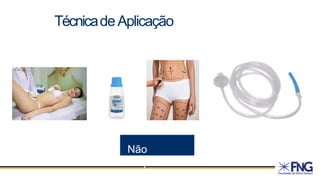 TécnicadeAplicação
Não
Esquecer
 