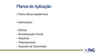 • Plano Meso-epidérmico
• Aplicações:
- Estrias
- Revitalização Facial
- Alopécia
- Telangectasia
- Sequela de Queimado
PlanosdeAplicação
 