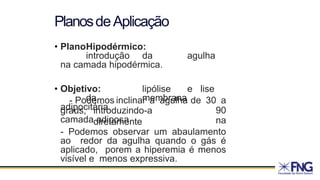 • PlanoHipodérmico:
introdução da agulha
na camada hipodérmica.
• Objetivo: lipólise e lise
da membrana
adipocitária.
graus, introduzindo-a
diretamente
- Podemos inclinar a agulha de 30 a
90
na
camada adiposa
- Podemos observar um abaulamento
ao redor da agulha quando o gás é
aplicado, porem a hiperemia é menos
visível e menos expressiva.
PlanosdeAplicação
 