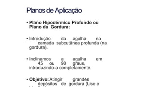 • Plano Hipodérmico Profundo ou
Plano da Gordura:
• Introdução da agulha na
camada subcutânea profunda (na
gordura).
• Inclinamos a agulha em
45 ou 90 graus,
introduzindo-a completamente.
• Objetivo:Atingir grandes
depósitos de gordura (Lise e
PlanosdeAplicação
 