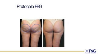 ProtocoloFEG
 