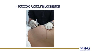Protocolo GorduraLocalizada
 