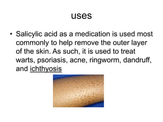 uses
• Salicylic acid as a medication is used most
commonly to help remove the outer layer
of the skin. As such, it is used to treat
warts, psoriasis, acne, ringworm, dandruff,
and ichthyosis
 