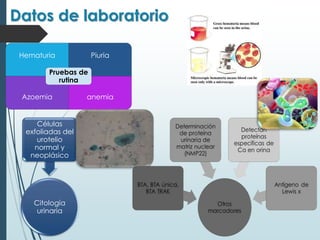 Datos de laboratorio
Hematuria Piuria
Azoemia anemia
Pruebas de
rutina
Citología
urinaria
Células
exfoliadas del
urotelio
normal y
neoplásico
 