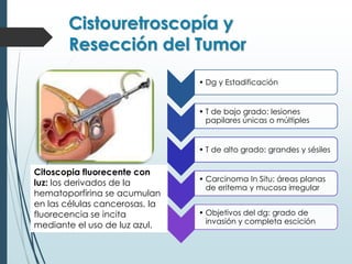 Cistouretroscopía y
Resección del Tumor
• Dg y Estadificación
• T de bajo grado: lesiones
papilares únicas o múltiples
• T de alto grado: grandes y sésiles
• Carcinoma In Situ: áreas planas
de eritema y mucosa irregular
• Objetivos del dg: grado de
invasión y completa escición
Citoscopia fluorecente con
luz: los derivados de la
hematoporfirina se acumulan
en las células cancerosas, la
fluorecencia se incita
mediante el uso de luz azul.
 