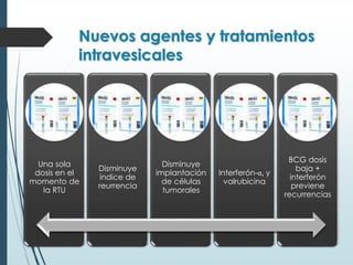 Nuevos agentes y tratamientos
intravesicales
Una sola
dosis en el
momento de
la RTU
Disminuye
índice de
reurrencia
Disminuye
implantación
de células
tumorales
Interferón-α, y
valrubicina
BCG dosis
baja +
interferón
previene
recurrencias
 