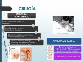 CIRUGÍA
Forma inicial para todos los
cánceres
Estadío, grado del tumor,
tratamiento adicional
Cánceres vesicales superficiales
recurren en el 30-80%
Lesiones solitarias de bajo
grado, sin recurrencia a los tres
meses, cistoscopia al año
RESECCIÓN
TRANSURETRAL
CICTECTOMÍA PARCIAL
Tumores solitarios e
infiltrantes (T1-T3) en pared
posterolateral o cúpula
Cánceres en un divertículo
 