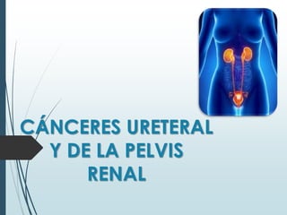 CÁNCERES URETERAL
Y DE LA PELVIS
RENAL
 