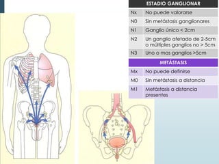 ESTADIO GANGLIONAR
Nx No puede valorarse
N0 Sin metástasis ganglionares
N1 Ganglio único < 2cm
N2 Un ganglio afetado de 2-5cm
o múltiples ganglios no > 5cm
N3 Uno o mas ganglios >5cm
METÁSTASIS
Mx No puede definirse
M0 Sin metástasis a distancia
M1 Metástasis a distancia
presentes
 