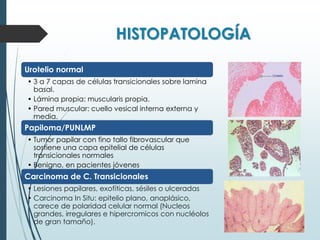HISTOPATOLOGÍA
Urotelio normal
• 3 a 7 capas de células transicionales sobre lamina
basal.
• Lámina propia: muscularis propia.
• Pared muscular: cuello vesical interna externa y
media.
Papiloma/PUNLMP
• Tumor papilar con fino tallo fibrovascular que
sostiene una capa epitelial de células
transicionales normales
• Benigno, en pacientes jóvenes
Carcinoma de C. Transicionales
• Lesiones papilares, exofíticas, sésiles o ulceradas
• Carcinoma In Situ: epitelio plano, anaplásico,
carece de polaridad celular normal (Nucleos
grandes, irregulares e hipercromicos con nucléolos
de gran tamaño).
 