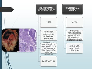 CARCINOMAS
INDIFERENCIADOS
< 2%
No tienen
elementos
epiteliales
maduros
Tumores con
características
neuroendócrinos
y carcinoma de
células pequeñas
son muy
agresivos
Metástasis
CARCINOMA
MIXTO
4-6%
Patrones
transicionales,
glandulares,
escamosos, o
indiferenciados
Al dg. Son
grandes e
infiltrantes
 