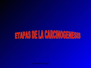 ETAPAS DE LA CARCINOGENESIS 