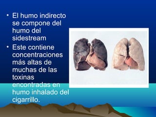 • El humo indirecto
se compone del
humo del
sidestream
• Este contiene
concentraciones
más altas de
muchas de las
toxinas
encontradas en
humo inhalado del
cigarrillo.

 