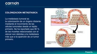 COLONIZACION METASTASICA
La metástasis tumoral es
la colonización de un órgano distante
mediante el movimiento de las
células tumorales desde un tejido
primario. Se ha reportado que 90 %
de las muertes relacionadas con el
cáncer son debidas a la metástasis
más que a la aparición de un tumor
primario.
 
