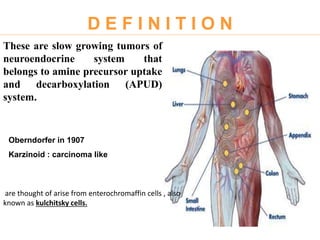 Carcinoid tumors | PPTX