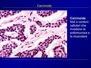 Carcinoide Carcinoide Nidi e cordoni cellulari che invadono la sottomucosa e la muscolare 