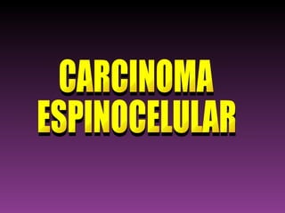 CARCINOMA ESPINOCELULAR 