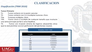 CLASIFICACION
 
