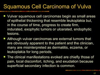 Squamous Cell Carcinoma  of Vulva Vulvar squamous cell carcinomas begin as small areas of epithelial thickening that resemble leukoplakia but, in the course of time, progress to create firm, indurated, exophytic tumors or ulcerated, endophytic lesions.  Although vulvar carcinomas are external tumors that are obviously apparent to the patient and the clinician, many are misinterpreted as dermatitis, eczema, or leukoplakia for long periods.  The clinical manifestations evoked are chiefly those of pain, local discomfort, itching, and exudation because superficial secondary infection is common. 