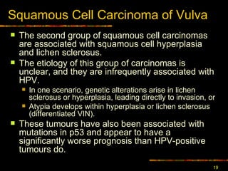 Squamous Cell Carcinoma  of Vulva The second group of squamous cell carcinomas are associated with squamous cell hyperplasia and lichen sclerosus.  The etiology of this group of carcinomas is unclear, and they are infrequently associated with HPV.  In one scenario, genetic alterations arise in lichen sclerosus or hyperplasia, leading directly to invasion, or  Atypia develops within hyperplasia or lichen sclerosus (differentiated VIN).  These tumours have also been associated with mutations in p53 and appear to have a significantly worse prognosis than HPV-positive tumours do.  