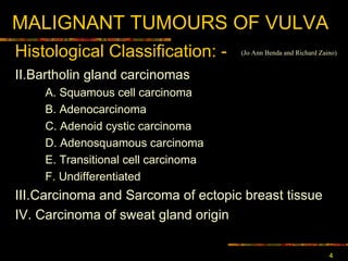 MALIGNANT TUMOURS OF VULVA II.Bartholin gland carcinomas  A. Squamous cell carcinoma  B. Adenocarcinoma  C. Adenoid cystic carcinoma  D. Adenosquamous carcinoma  E. Transitional cell carcinoma  F. Undifferentiated  III.Carcinoma and Sarcoma of ectopic breast tissue IV. Carcinoma of sweat gland origi n Histological Classification : - (Jo Ann Benda and Richard Zaino) 