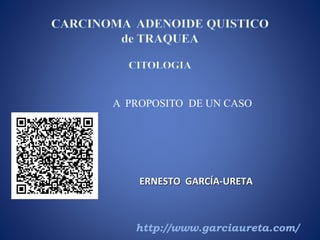ERNESTO GARCÍA-URETA
http://www.garciaureta.com/
A PROPOSITO DE UN CASO
 