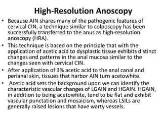 Anain Ranges Carcinoma anal canal | PPTX