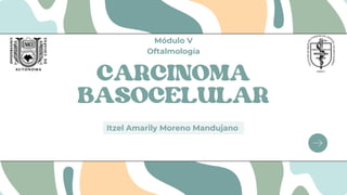 CARCINOMA
BASOCELULAR
Itzel Amarily Moreno Mandujano
Módulo V
Oftalmología
 