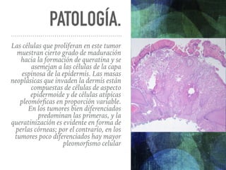 PATOLOGÍA.
Las células que proliferan en este tumor
muestran cierto grado de maduración
hacia la formación de queratina y ...