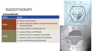 RADIOTHERAPY
Conventional:
 