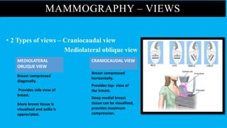 Visualised Compression Pathology and management of carcinoma breast | PPTX
