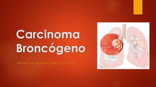 Carcinoma
Broncógeno
ASUNCY A. ACOSTA GARCIA CI-4776
 