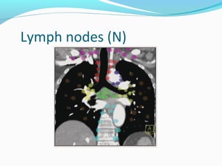 Lymph nodes (N)

 