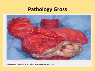Pathology Gross
 