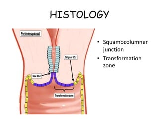 HISTOLOGY
• Squamocolumner
junction
• Transformation
zone
 