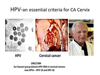 HPV-an essential criteria for CA Cervix
 