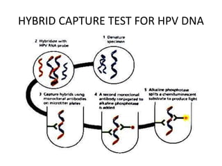 HYBRID CAPTURE TEST FOR HPV DNA
 