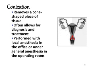 29
Conization
•Removes a cone-
shaped piece of
tissue
•Often allows for
diagnosis and
treatment
•Performed with
local anesthesia in
the office or under
general anesthesia in
the operating room
 