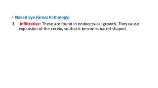 • Naked Eye (Gross Pathology)
3. Infiltrative: These are found in endocervical growth. They cause
expansion of the cervix, so that it becomes barrel-shaped.
 