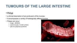 TUMOURS OF THE LARGE INTESTINE
• Polyp
• a clinical description of any protrusion of the mucosa.
• It encompasses a variety of histologically different tumors.
• Polyps can occur
• single – BENIGN
• synchronously in small numbers
• part of a polyposis syndrome
 