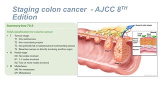 Staging colon cancer - AJCC 8TH
Edition
 