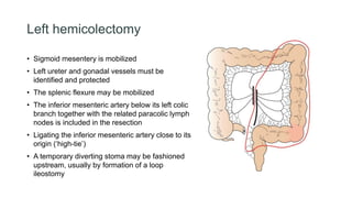 Left hemicolectomy
• Sigmoid mesentery is mobilized
• Left ureter and gonadal vessels must be
identified and protected
• The splenic flexure may be mobilized
• The inferior mesenteric artery below its left colic
branch together with the related paracolic lymph
nodes is included in the resection
• Ligating the inferior mesenteric artery close to its
origin (‘high-tie’)
• A temporary diverting stoma may be fashioned
upstream, usually by formation of a loop
ileostomy
 