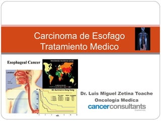 Carcinoma de Esofago
 Tratamiento Medico




          Dr. Luis Miguel Zetina Toache
                Oncología Medica
              Cáncer Consultants GT
 
